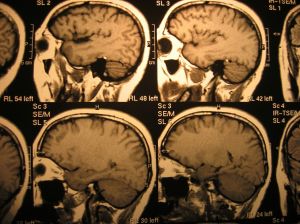 666035_x-ray_head